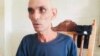 Periodista independiente Carlos Michael Morales tras 27 días en huelga de hambre (Cortesía de Guillermo del Sol)