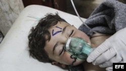 Un niño recibe tratamiento médico tras un supuesto ataque químico contra la localidad de Jan Shijún.