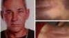 Alejandro Pupo Echemendía. A la derecha, fotos tomadas por sus familiares con las huellas de una golpiza policial que recibió en Placetas y acabó con su vida.