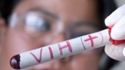 Crítica la situación de los enfermos de VIH Cuba Crítica la situación de los enfermos de VIH Cuba