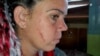 Bárbara Farrat muestra los arañazos tras el ataque del jueves. (Foto: CubaNet)