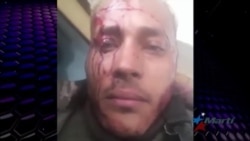 Muerte de Oscar Pérez reaviva malestar de los ciudadanos en Venezuela Muerte de Oscar Pérez reaviva malestar de los ciudadanos en Venezuela